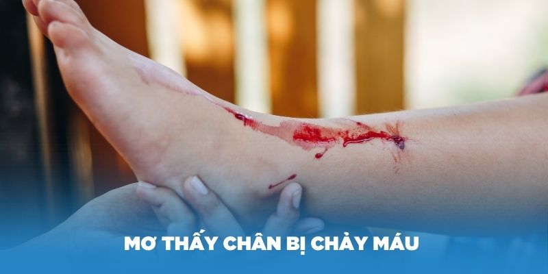 Mơ thấy chân bị chảy máu là ý nghĩa gì