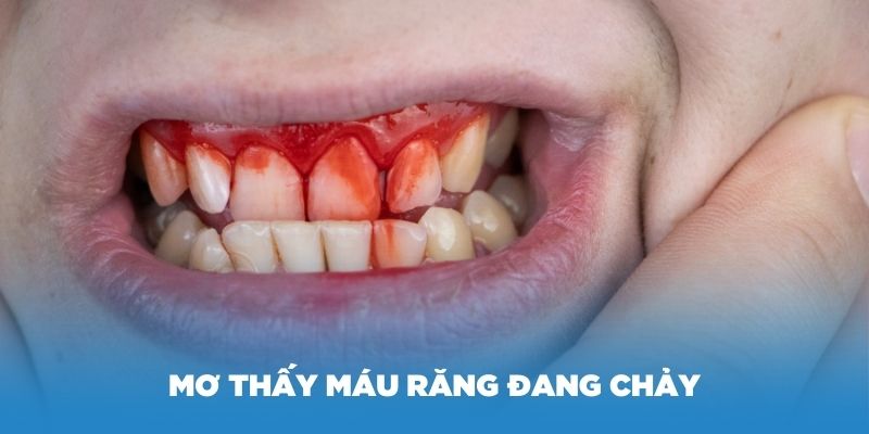 Mơ thấy máu răng đang chảy